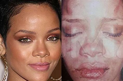 rhiana leaked|Alleged Private Photos of Rihanna and Chris Brown Leak